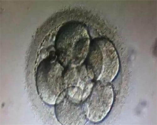 东莞靠谱试管助孕,东莞私人医院三代试管包生男孩价格多少？费用8万可信吗？