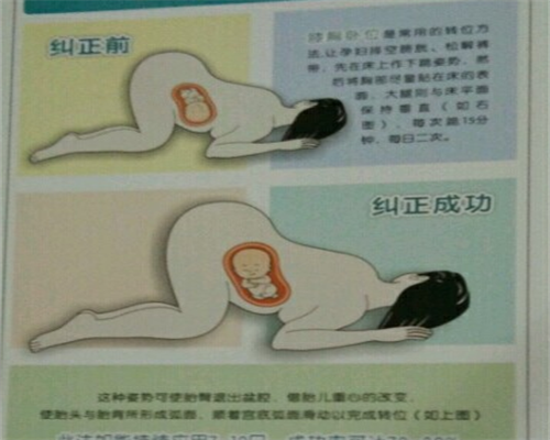 东莞代怀生子流程,东莞供卵试管婴儿医院排名？附生男孩医院明细？