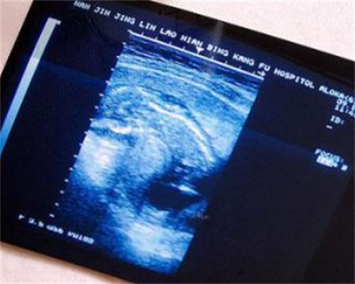 东莞试管助孕价格,东莞第三代试管婴儿医院费用多少？