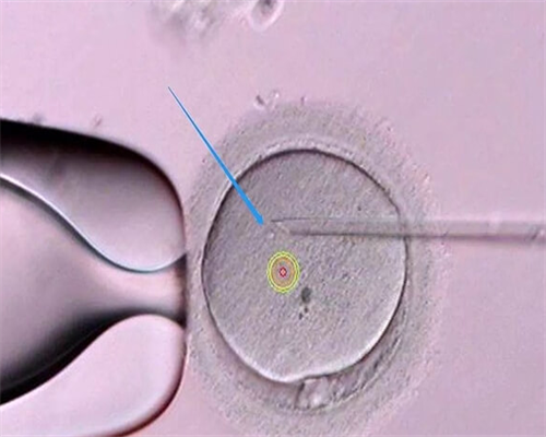 帮人东莞助孕联系电话,东莞康华医院供卵试管怎么样？东莞能做供卵试管吗？