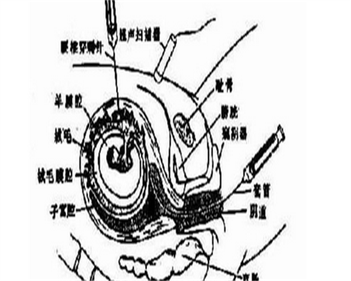 月经失调的症状：月经不多会造成不孕吗？