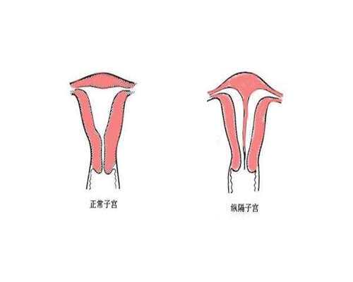 东莞三代试管助孕价格,东莞第三代试管婴儿医院费用多少？