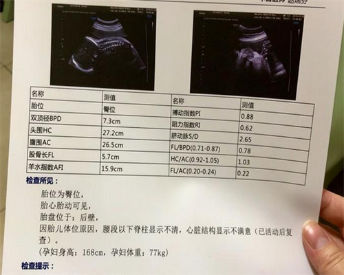 助孕捐卵机构-广州试管婴儿的成功率（广东试管婴儿技术最好）