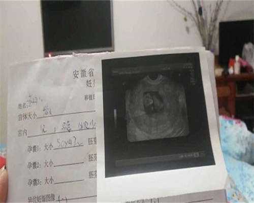 东莞招聘代孕吗，2026年东莞试管婴儿费用要花多少钱?去东莞做试管便宜吗?