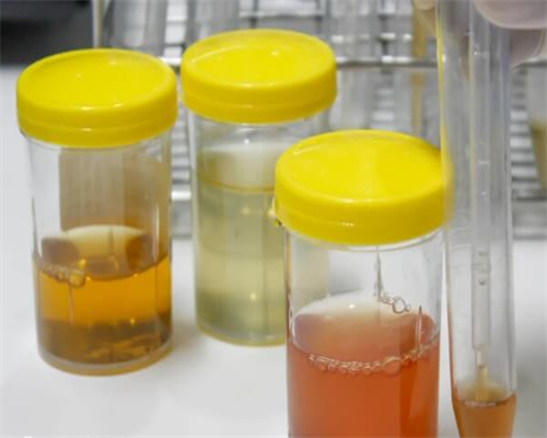 东莞试管婴儿价格咨询？对比东莞试管婴儿机构差异