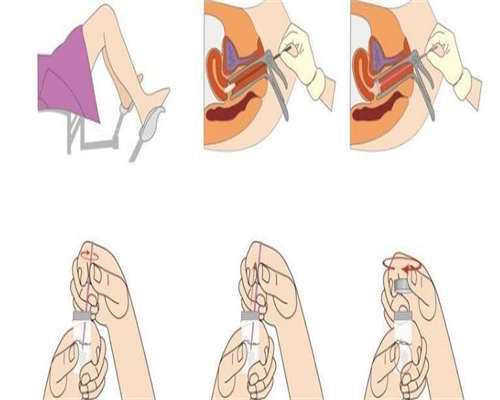 东莞代生价格明细，东莞试管包生男孩价格明细？附价格明细表！