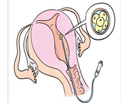 #遗传的角度看试管婴儿是亲生的吗？