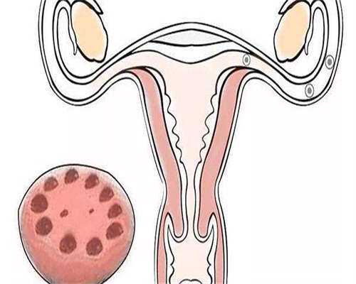 月经不调的症状有哪些,月经不调会导致不孕吗