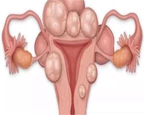 东莞供卵龙凤胎，东莞的陪产假是几天