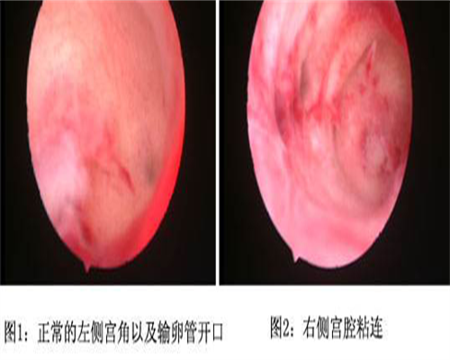 东莞代怀套餐,东莞试管包生男多少钱？去东莞做试管生男孩贵吗？