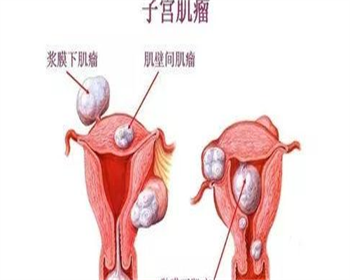 供卵增卵机构:高龄做三代试管婴儿养囊难还是囊胚PGS筛选通过更难