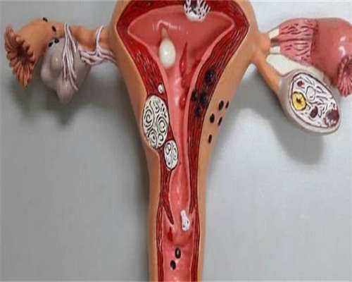 东莞供卵群，东莞市供卵医院有哪些？