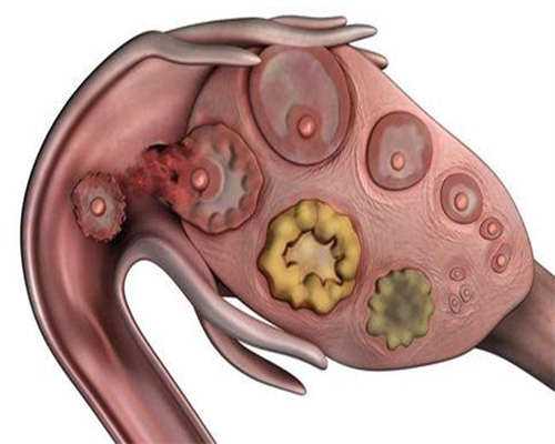 高龄备孕二胎，要不要检查排卵跟输卵管？
