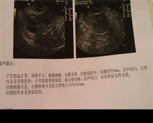 东莞代生儿子套餐，东莞做人流最专业最安全的医院