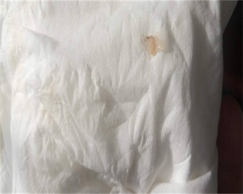 精因宝贝官网_试管代孕哪种成功率高,国内试管婴儿着床率约50%想快速怀孕怎么