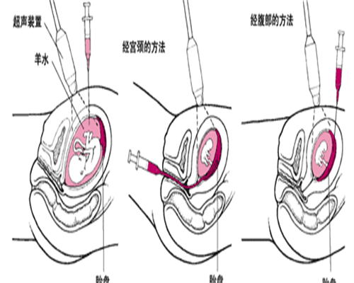 北京供卵试管生机构价格表，北京妇产科中医院是否有供卵？