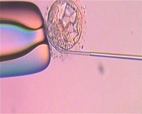 供卵价格高:移植三级10细胞胚胎的成功率高不高？三级10细胞胚胎的质量好不好？